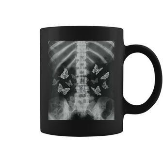 Squelette Xray Butterfly Egirl Y2k Harajuku Dark Grunge Edgy Tasse - Cadeauxyz