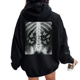 Squelette Xray Butterfly Egirl Y2k Harajuku Dark Grunge Edgy Sweat à capuche oversize pour femme avec imprimé dans le dos - Cadeauxyz
