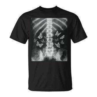 Squelette Xray Butterfly Egirl Y2k Harajuku Dark Grunge Edgy T-Shirt - Cadeauxyz
