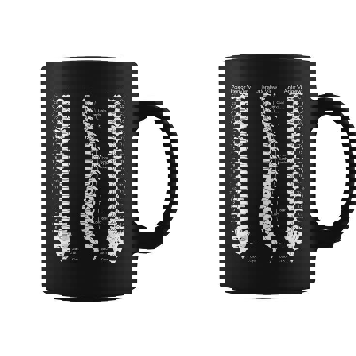 人間の脊椎解剖学カイロプラクティック図 コーヒーマグ